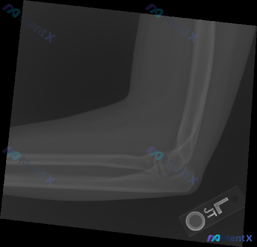 Post 4505 image 1