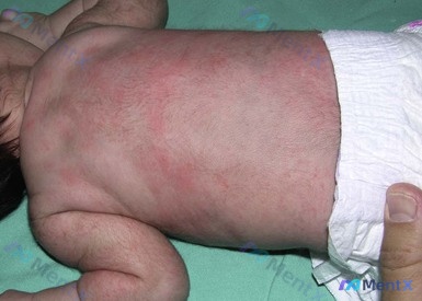 Post 102 image 1
