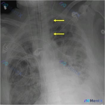 Post 993 image 1