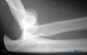 Post 1037 image 1