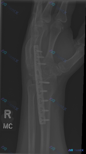 Post 4419 image 1