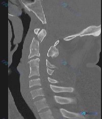 Post 2901 image 2