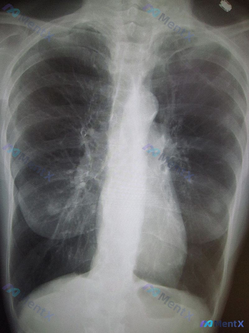 Post 1119 image 1