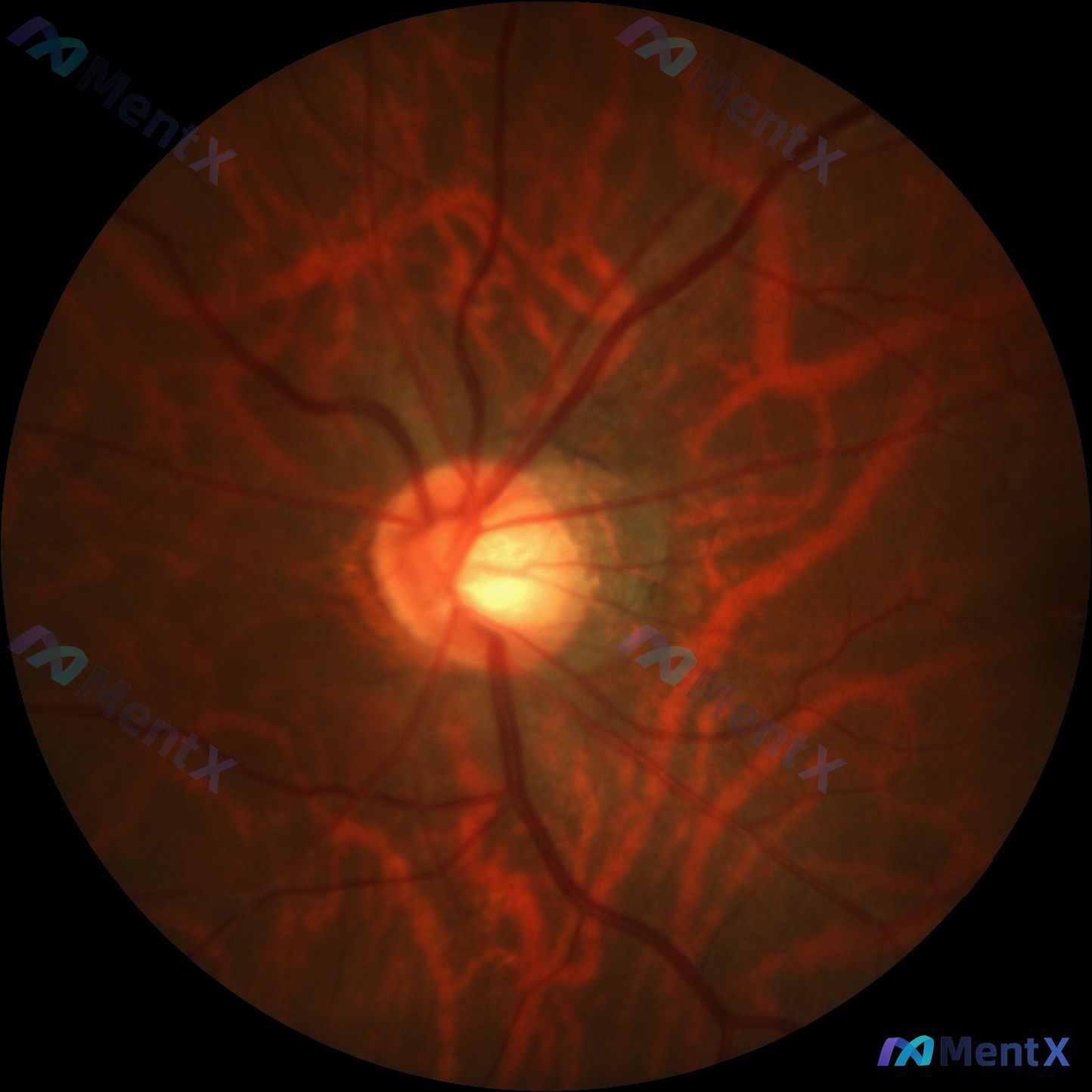 Post 2980 image 1