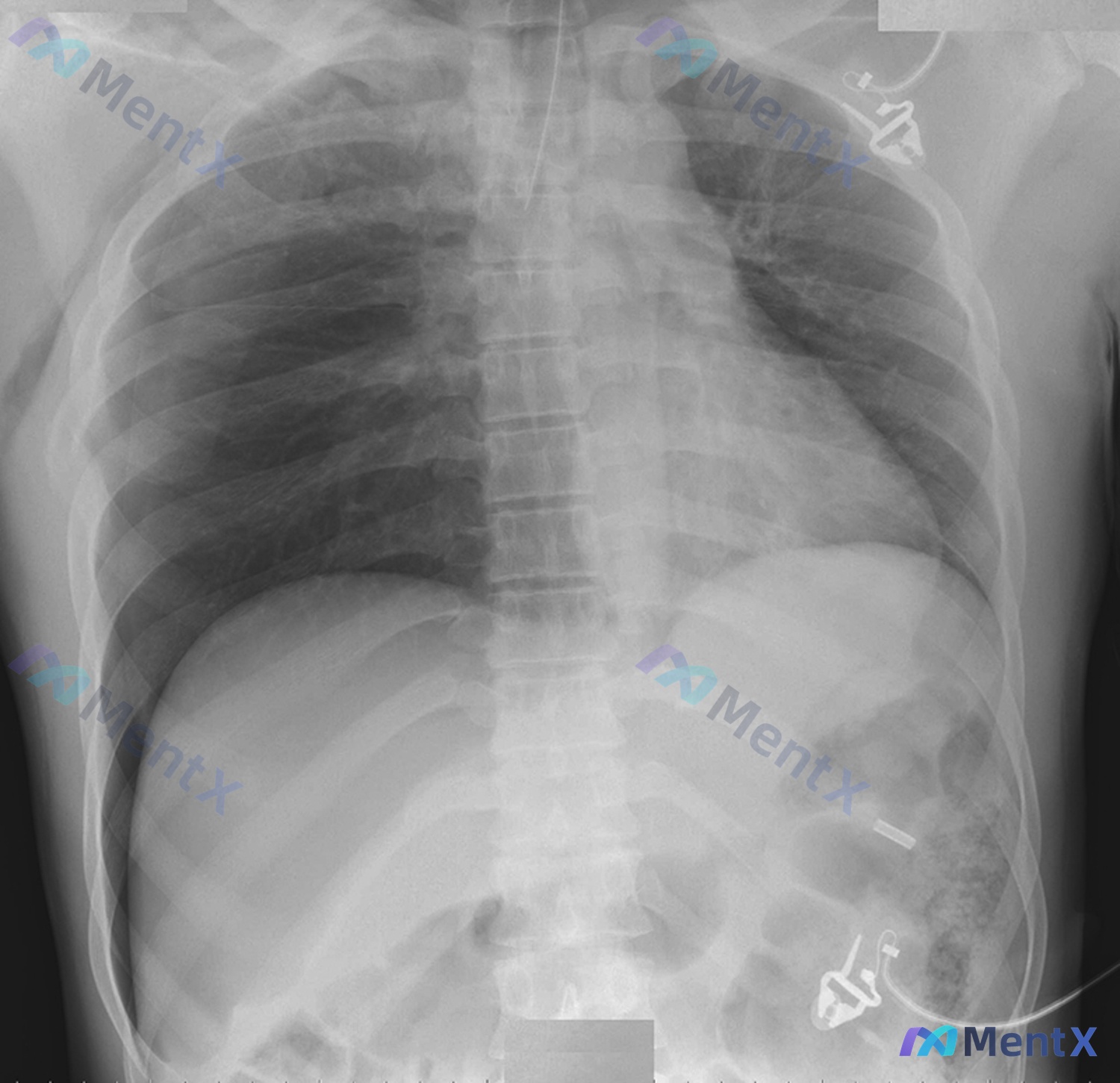 Post 2546 image 1