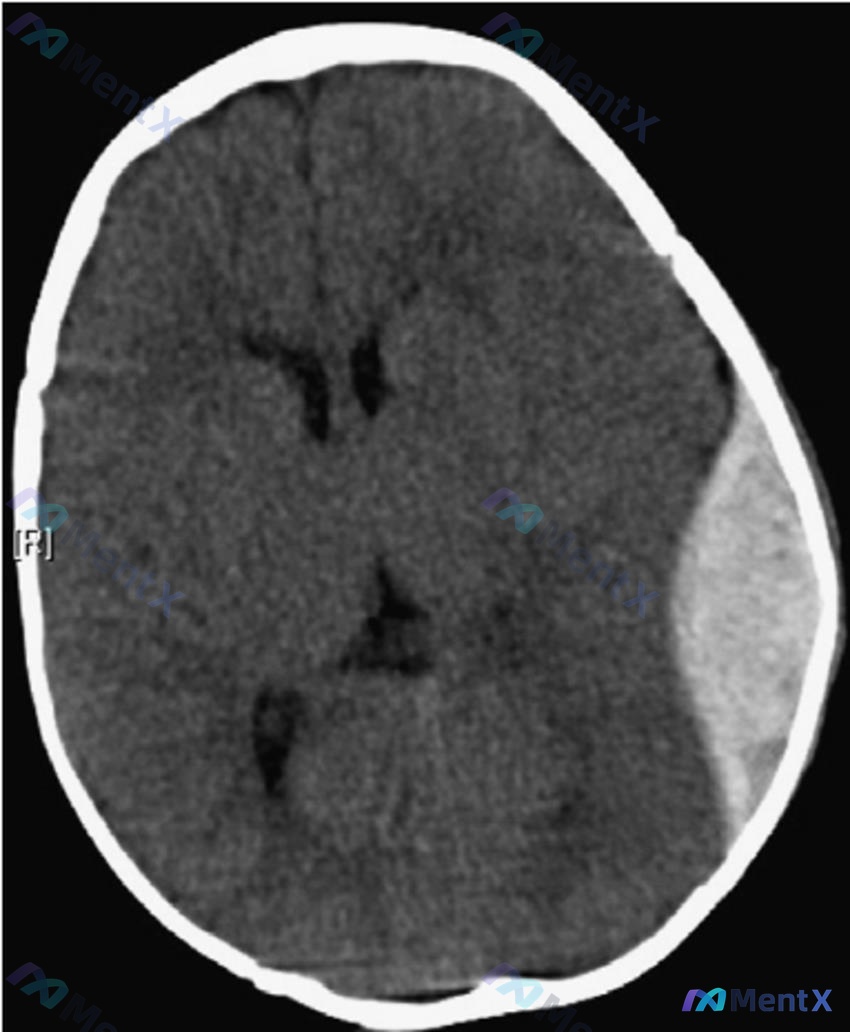 Post 148 image 1