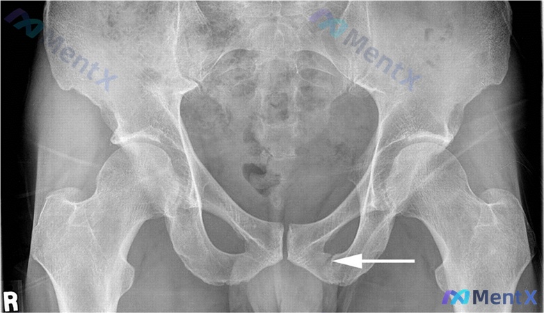 Post Image 5