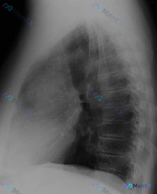 Post 1310 image 2