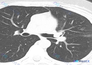 Post 2510 image 1