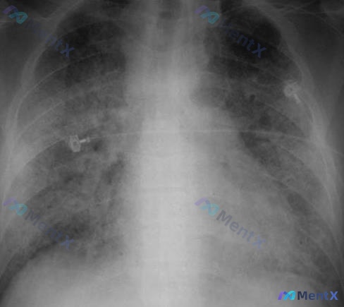 Post 650 image 1