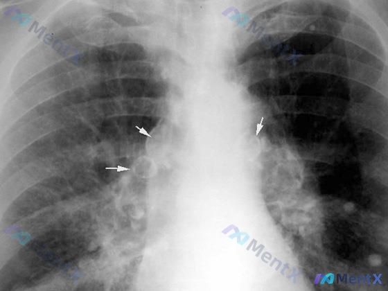 Post 2253 image 1