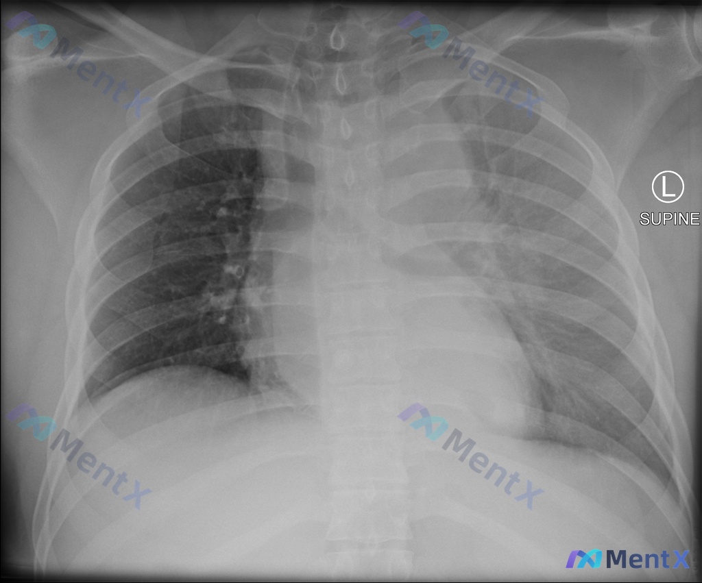 Post 124 image 1