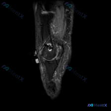 Post 27153 image 1