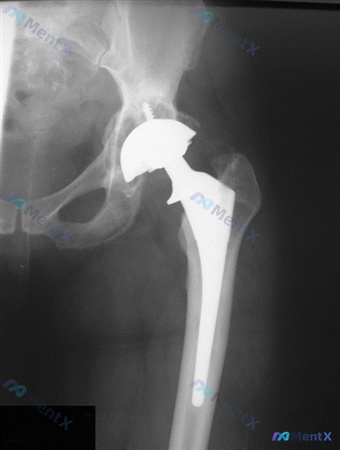 Post 1613 image 1