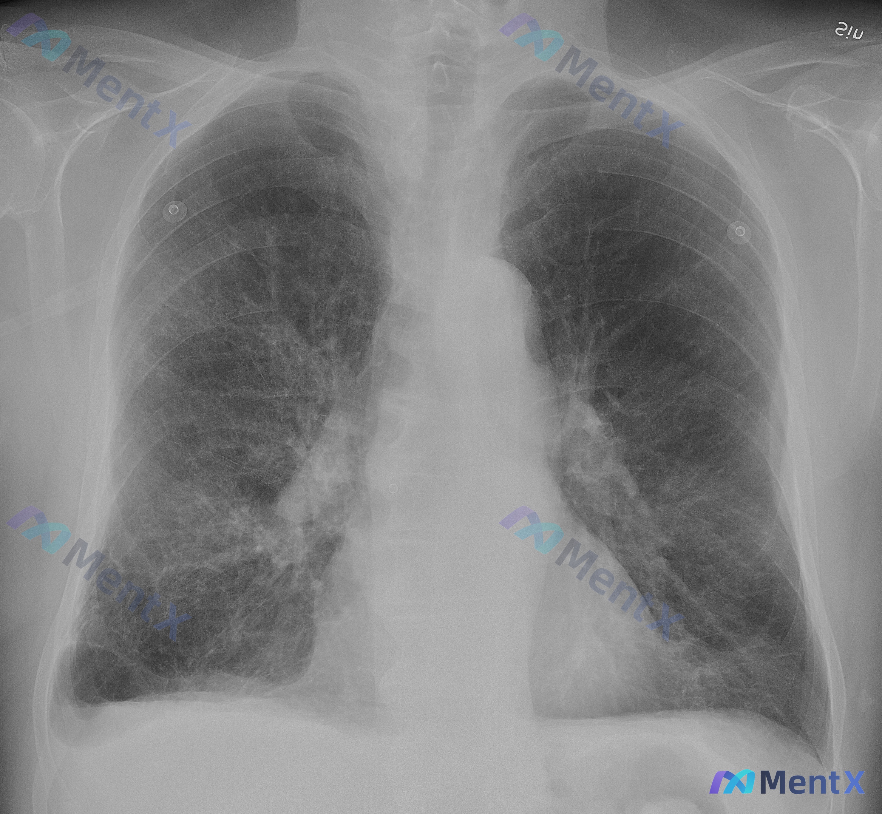Post 2063 image 1