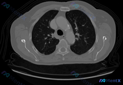 Post 1520 image 1