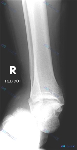 Post 2515 image 1