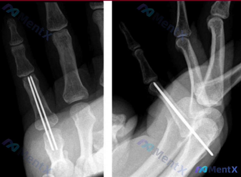 Post 507 image 2