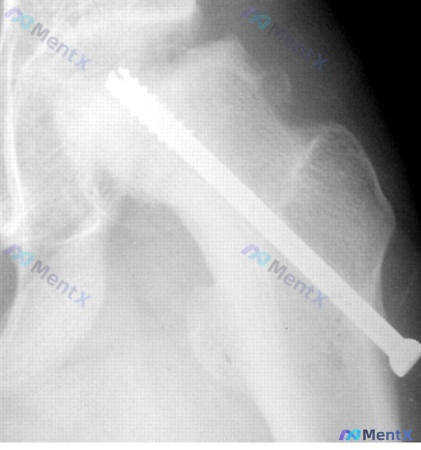 Post 1418 image 2
