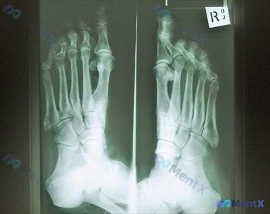 Post Image 2