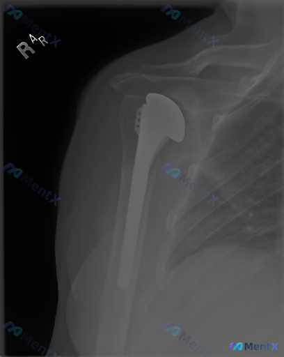 Post 3520 image 1