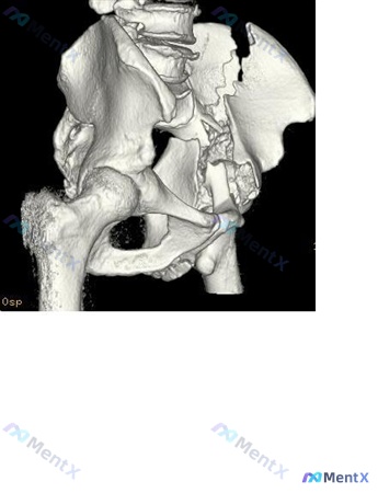 Post Image 4