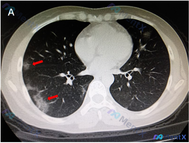 Post 890 image 1