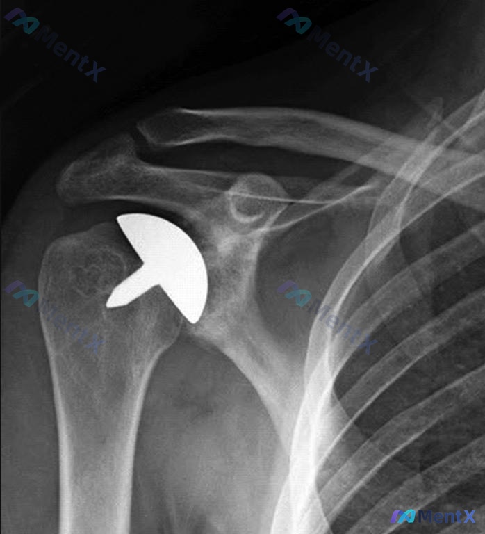 Post Image 5