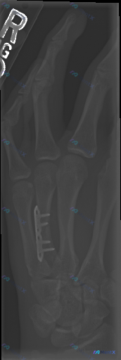 Post Image 1