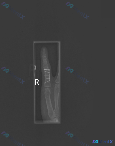 Post 4699 image 1