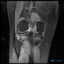 Post 41000 image 1