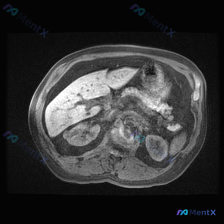 Post 42046 image 1
