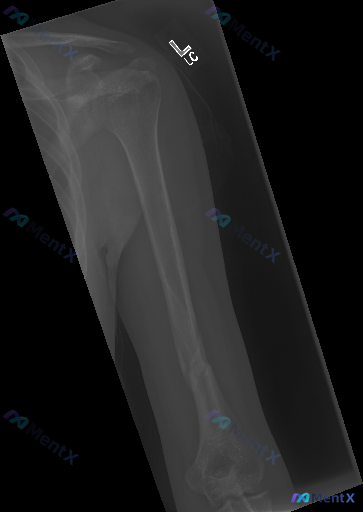 Post 3105 image 1
