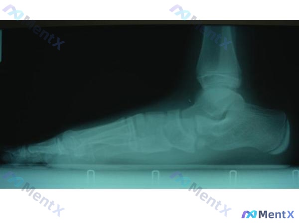 Post 97 image 3