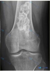 Post 200 image 1
