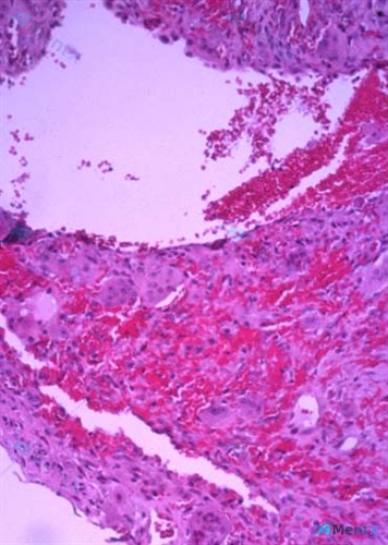 Post 33 image 2