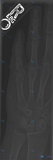 Post Image 1