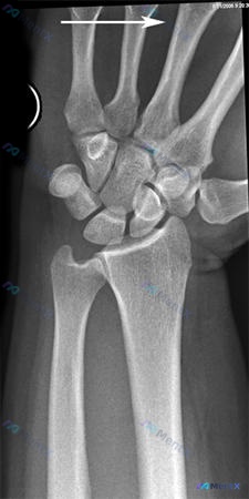 Post 1730 image 3