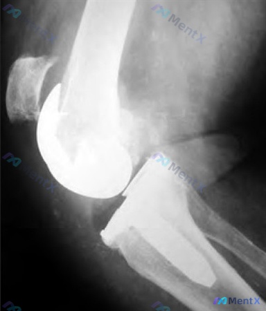 Post 2125 image 1