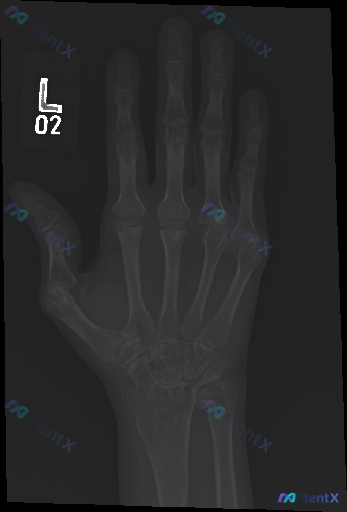 Post 4514 image 1