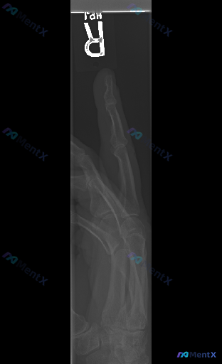 Post 4922 image 1