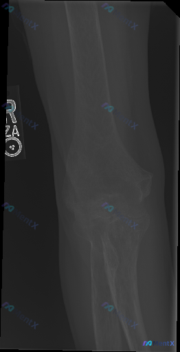 Post 4511 image 1