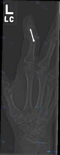 Post Image 1