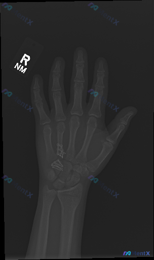 Post Image 1