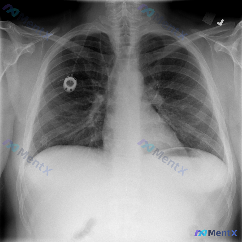 Post 2237 image 1