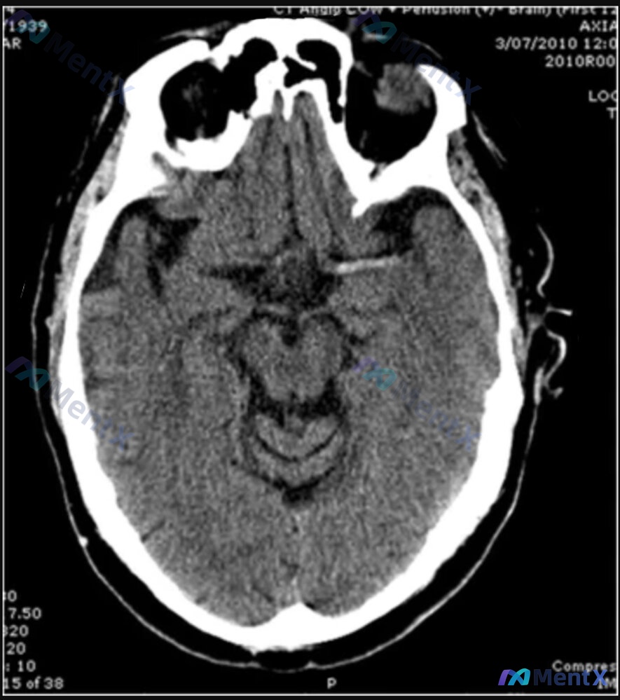 Post Image 1