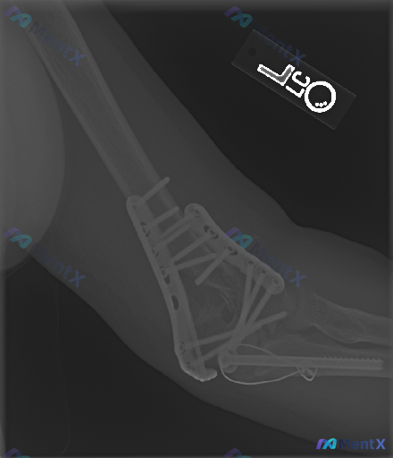 Post 4660 image 1