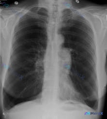 Post 2296 image 1