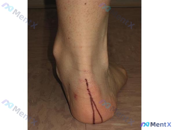 Post 97 image 2