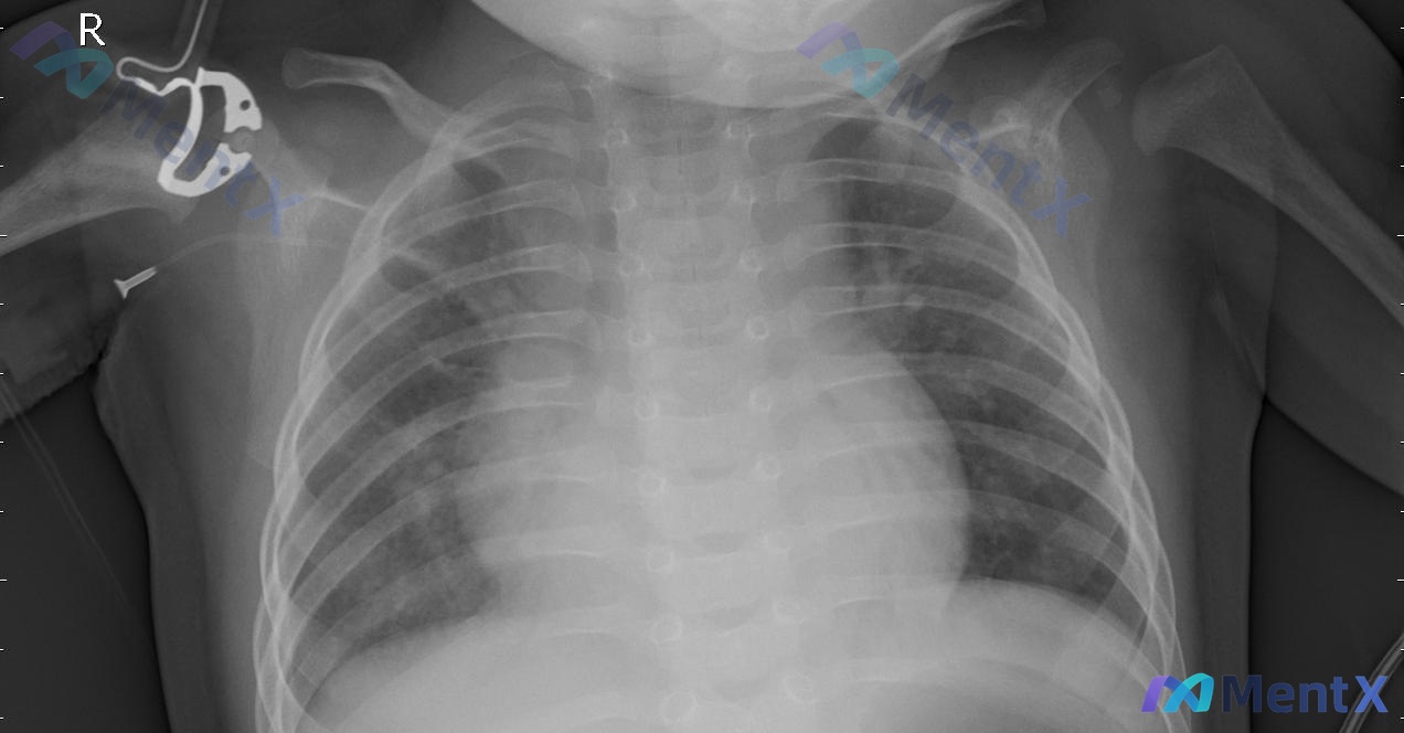 Post 2203 image 1